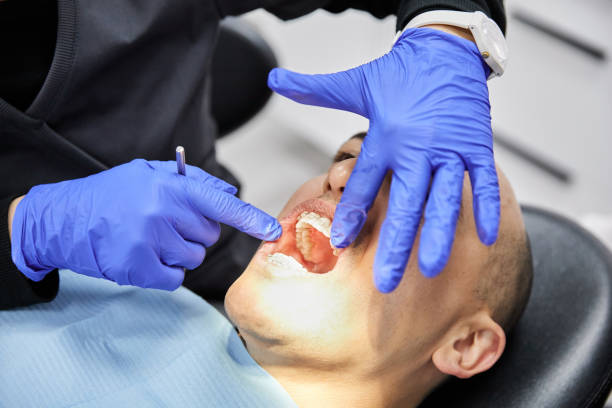 Best Knocked-Out Tooth Emergency  in Rossville, MD