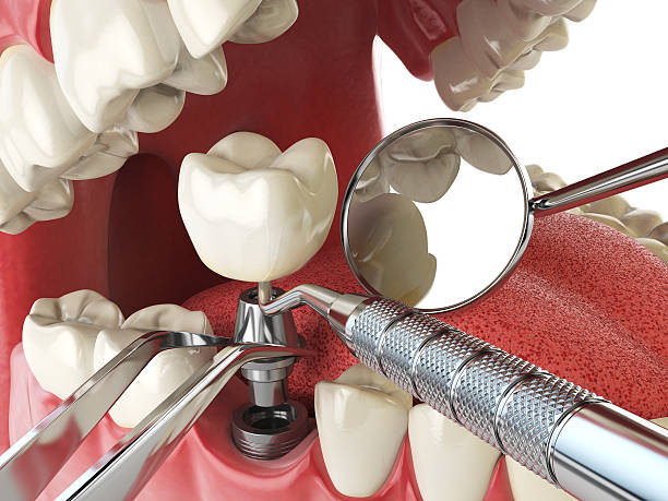 Best 24-Hour Emergency Dentist  in Rossville, MD